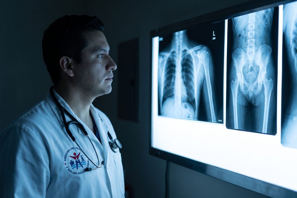 Médico MEDLAB revisa radiografías de hombro y cadera en el negatoscopio